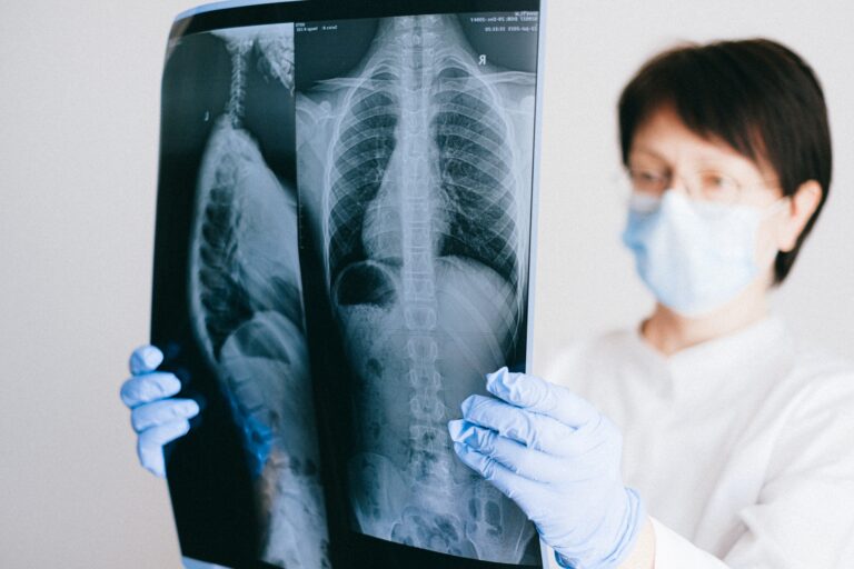 Silicosis Claims In Queensland Your Claim Lawyers
